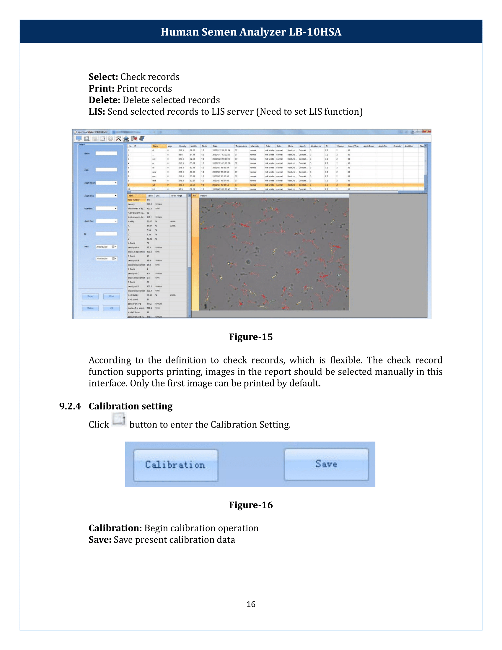 Human-Semen-Analyzer-LB-10HSA-17.png