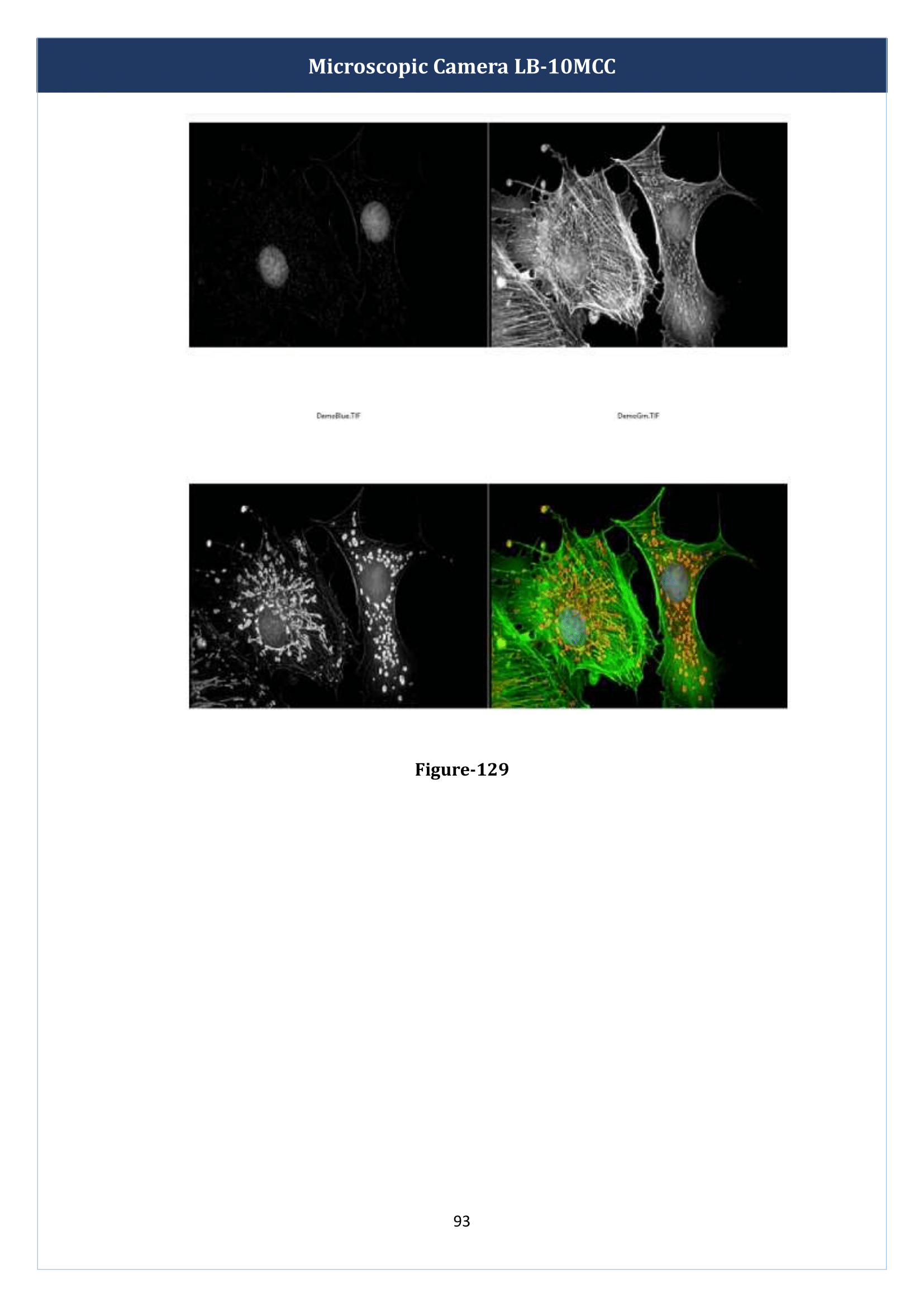microscopic-camera-lb-10mcc-94.png